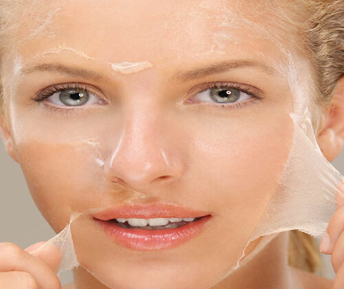 Chemical Peel Treatment in Delhi