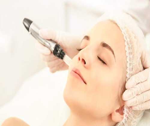 Micro needling treatment in delhi