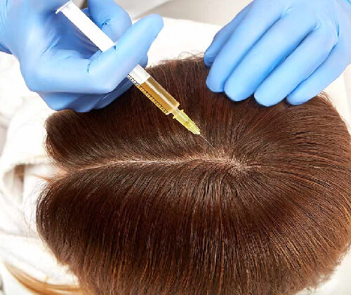 Mesotherapy Hair Treatment in Delhi