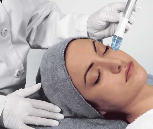 dermafrac treatment