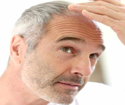 Hair Transplant clinic in Delhi